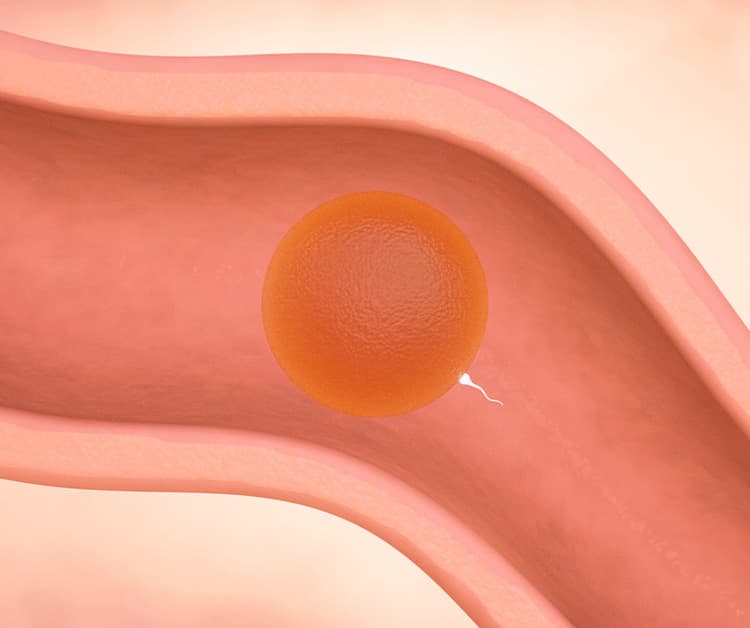 Sperm travels up the fallopian tubes to meet the egg